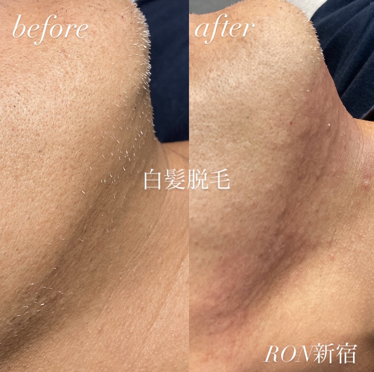 画像の説明 画像の説明