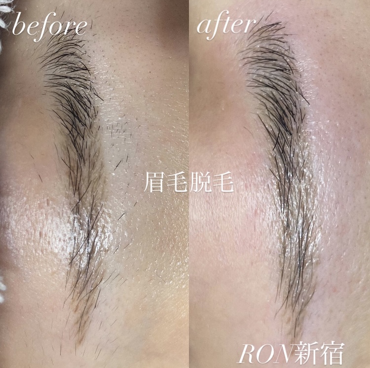 画像の説明 画像の説明