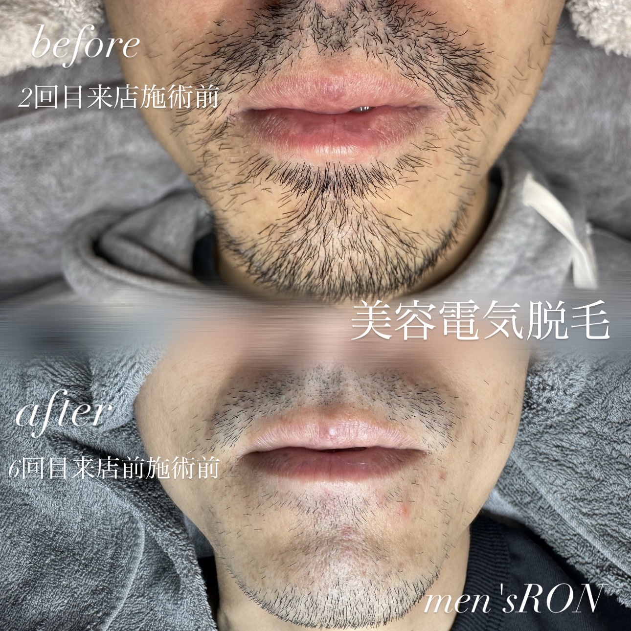 画像の説明