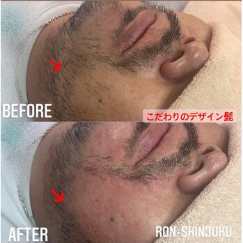 画像の説明