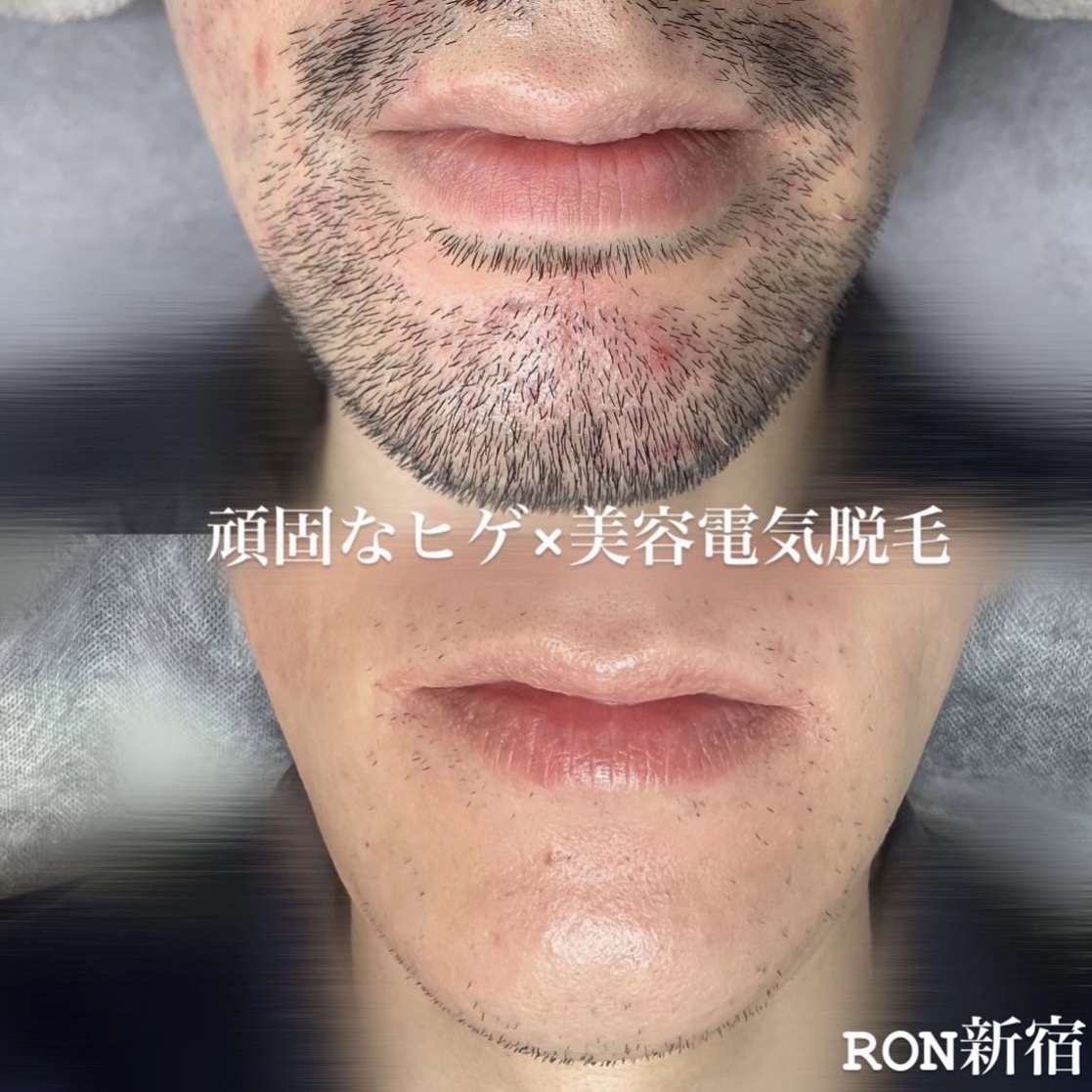 画像の説明