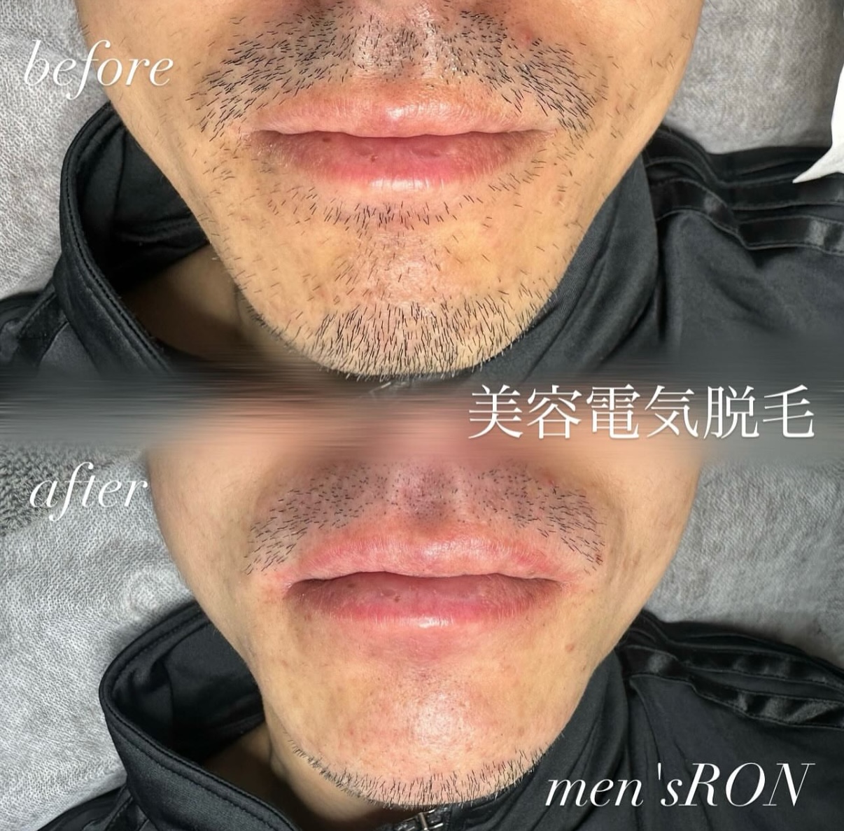 画像の説明