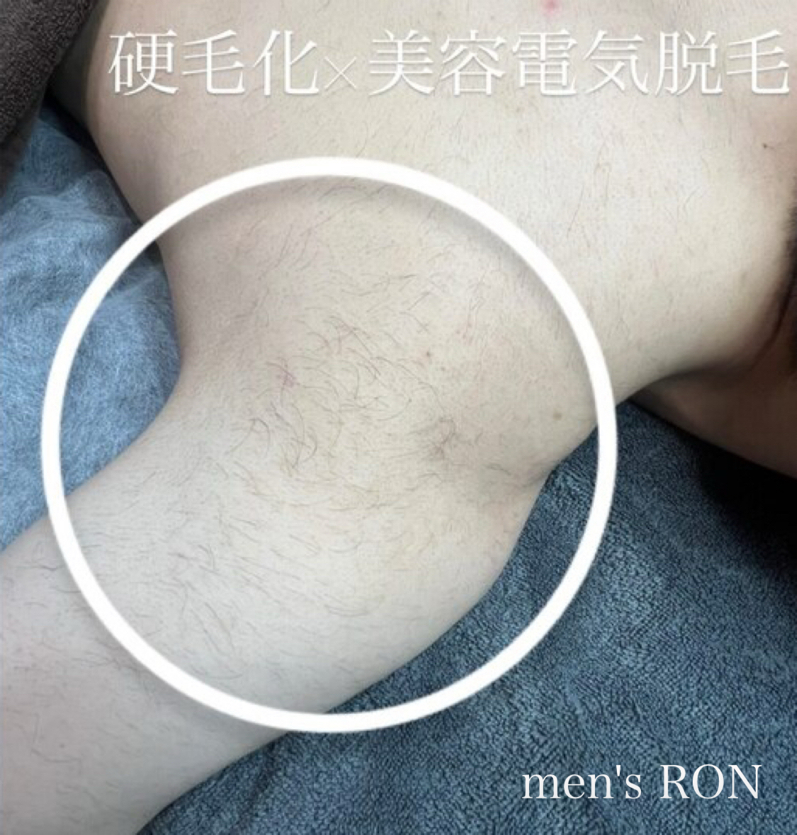 画像の説明