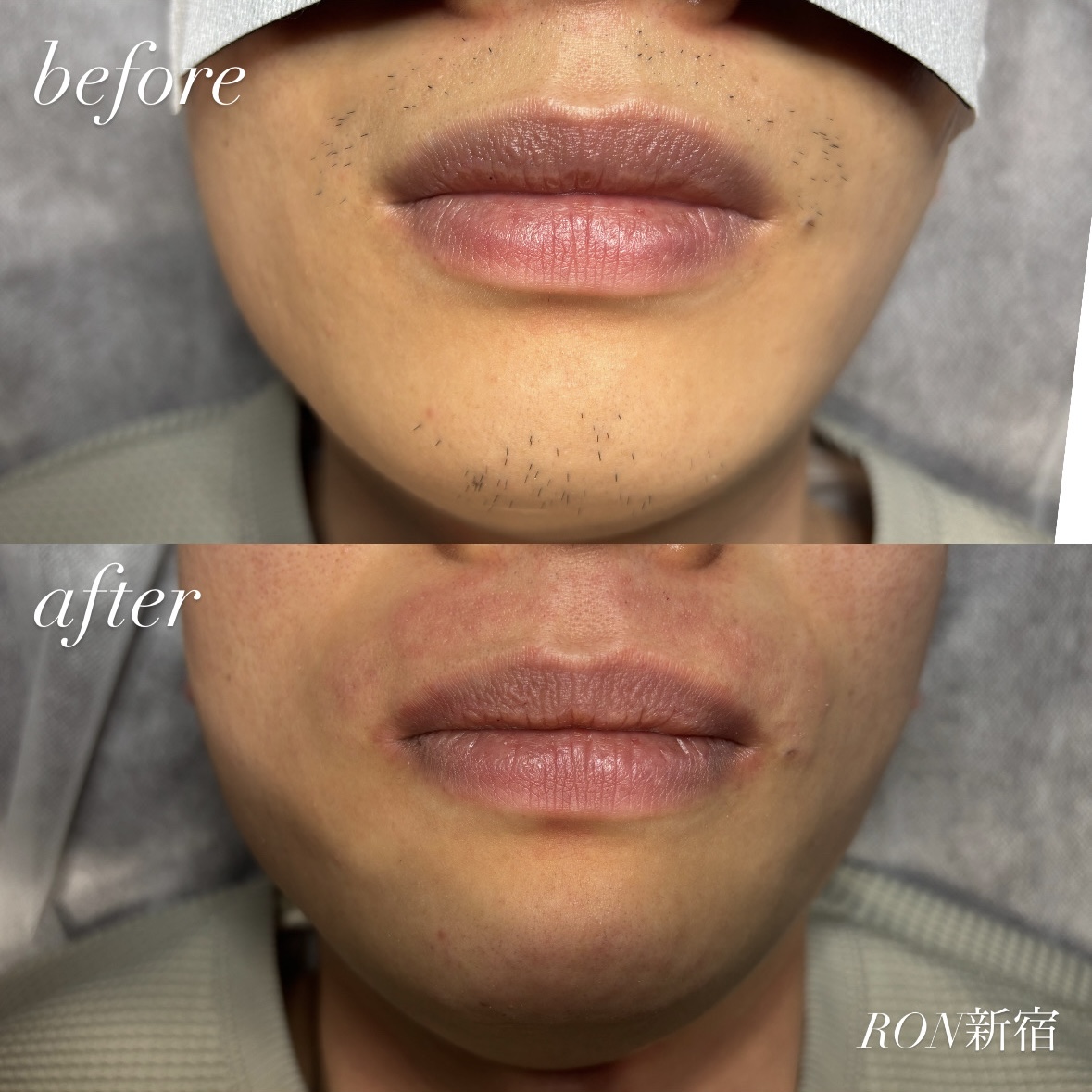 07C26E2C-3850-4410-B1E1-CB15E3891690 2 07C26E2C-3850-4410-B1E1-CB15E3891690 2