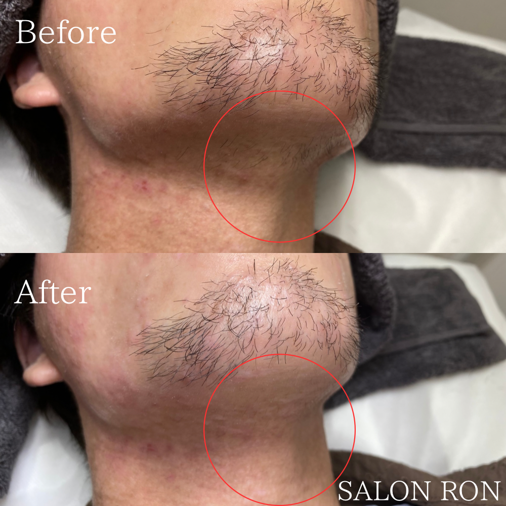 before - 54